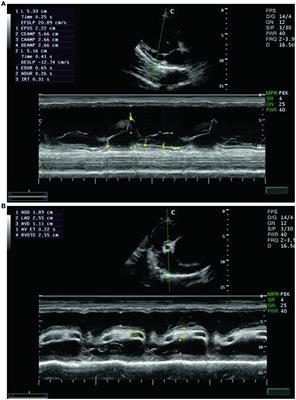 Evaluation of cardiac indices using M-mode echocardiography after administration of metoclopramide and ondansetron in donkeys (Equus asinus): an experimental study